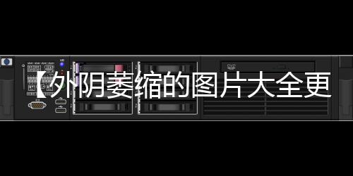 【外阴萎缩的图片大全更年期】2018世界杯德国惨败